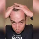 🌿✨ FEG Hair Growth Spray – Stop Hair Fall, Regrow Naturally & Strengthen Roots 💧💪